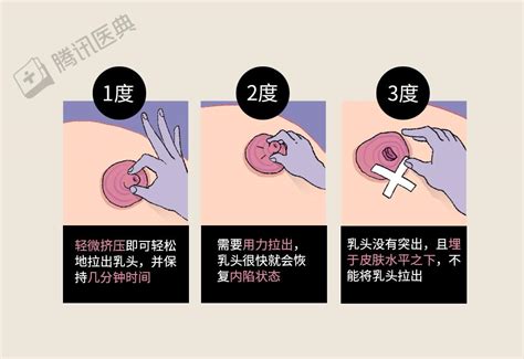 胸部长毛|乳头边上有毛毛正常吗？10 个你需要知道的小问题